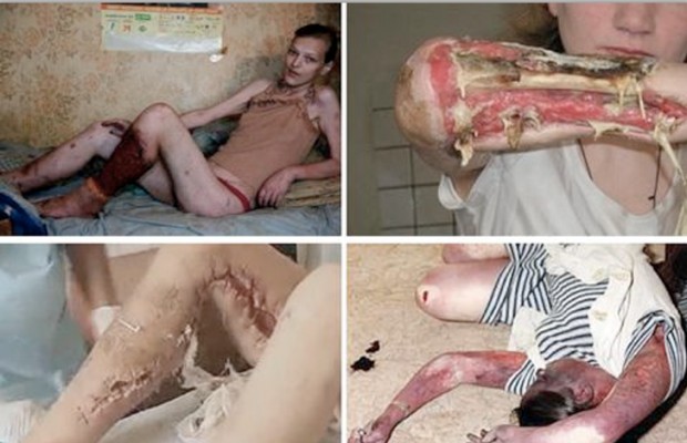 Krokodil