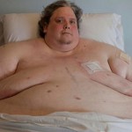 Persona obesa