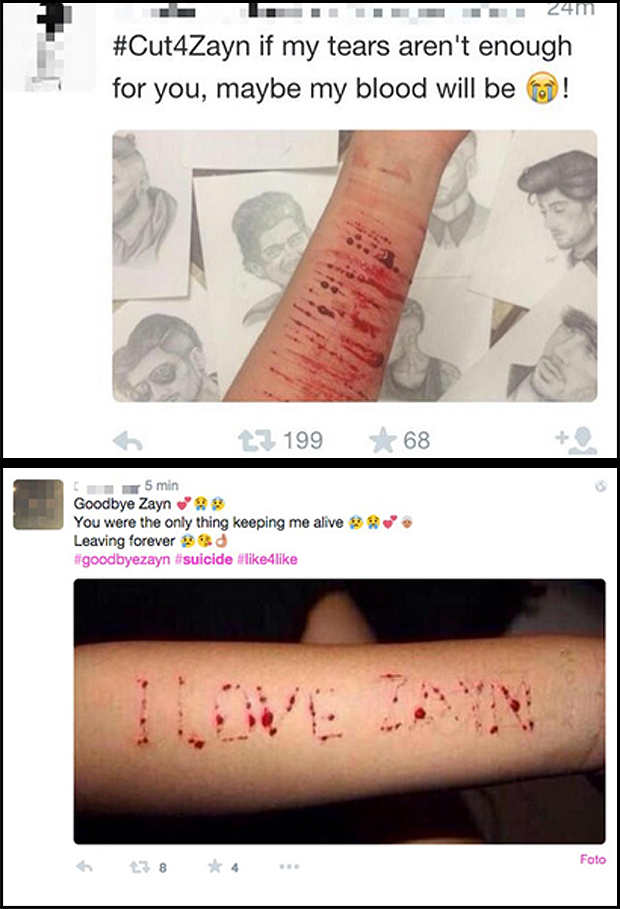 Atti di autolesionismo postati da una directioner su Twitter