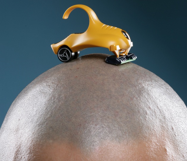 Non serve radersi, basta strappare i capelli giusti