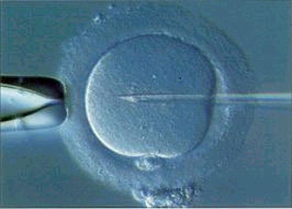 Fecondazione assistita