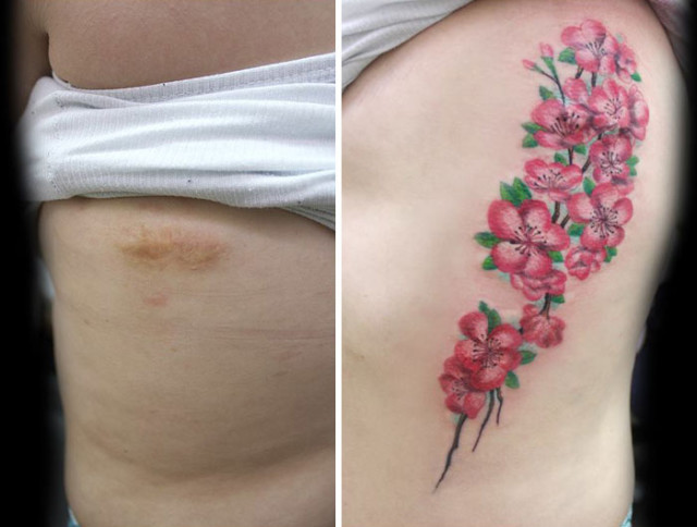 Cover up di una cicatrice della tatuatrice brasiliana