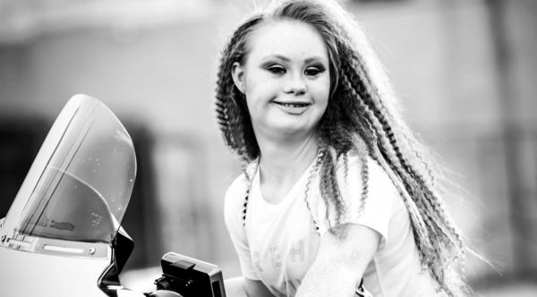 La modella australiana Madeline Stuart