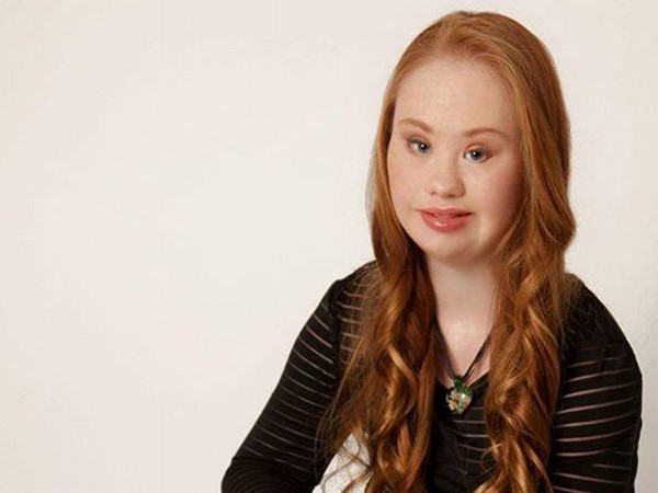 La modella down Madeline Stuart