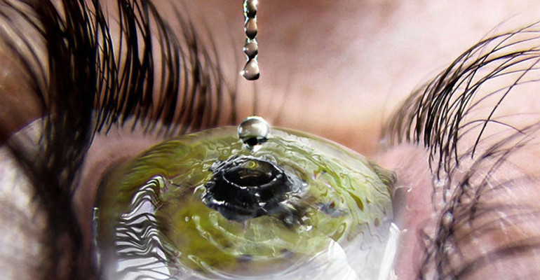 Malattie neurodegenerative: la svolta