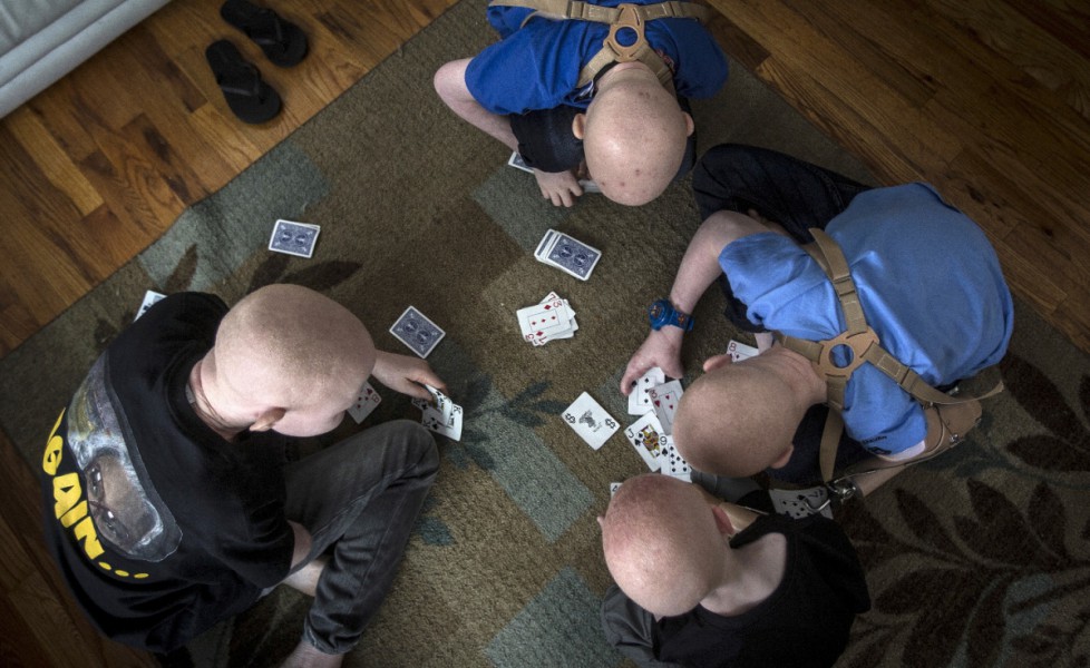 Bambini albini giocano a carte