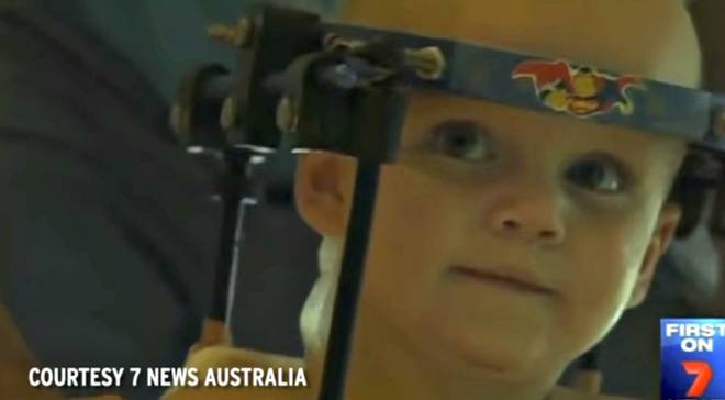 Jackson Taylor dopo l'operazione