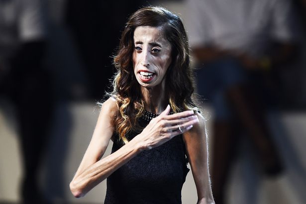 Lizzie Velasquez 3