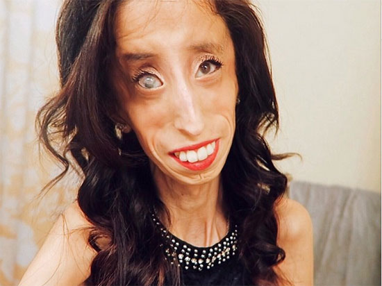Lizzie Velasquez 4