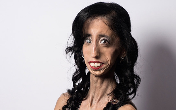 Lizzie La pi Brutta Del Mondo Contro Il Bullismo