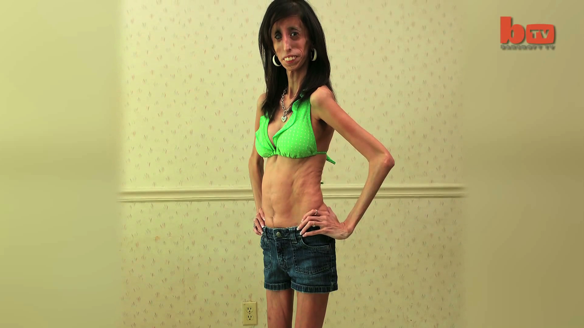Lizzie Velasquez 5