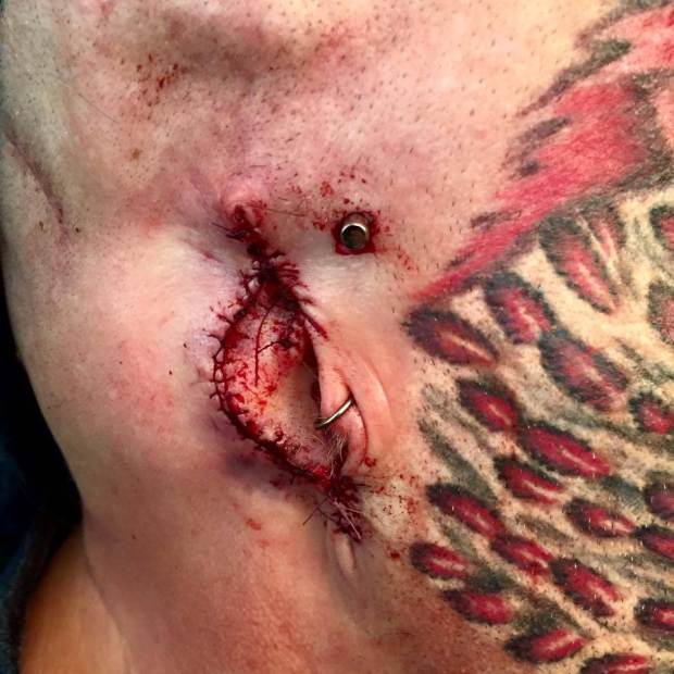 L'operazione alle orecchie