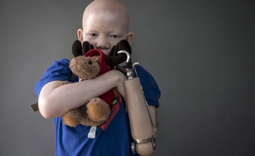 Mwigulu Matonage Magesa, 12 anni