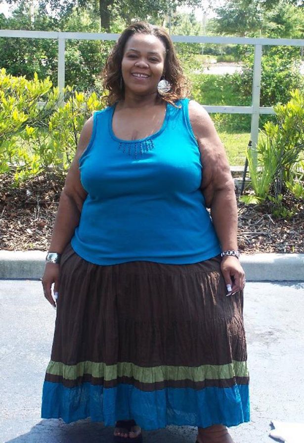 Catrina Raiford dopo aver perso peso 1