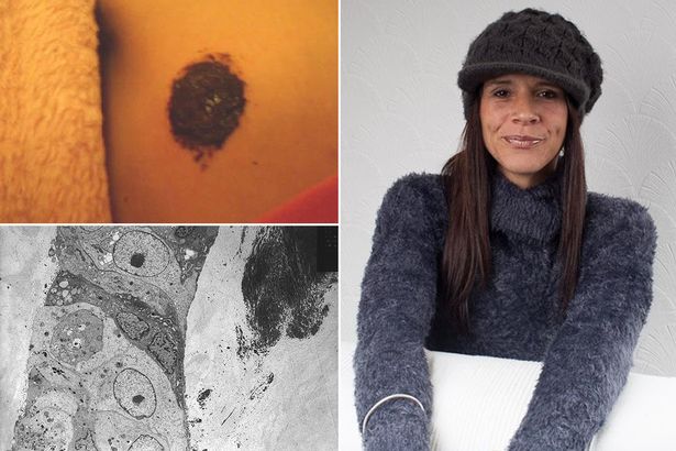 Sam Ravelle e il cancro a seno