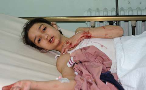 Violenza sui bambini 2