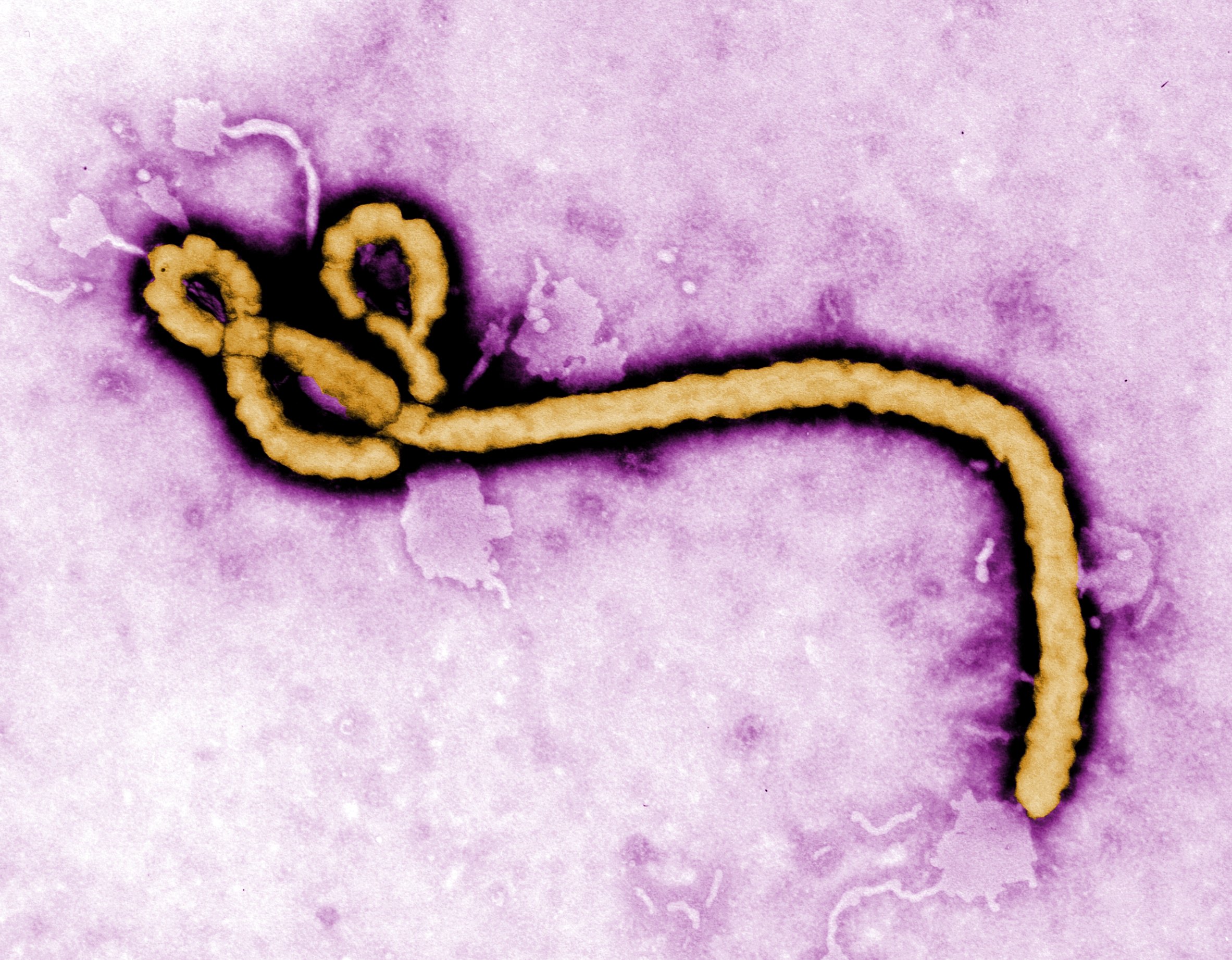 Virus Ebola 2