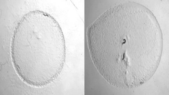 verme Caenorhabditis elegans