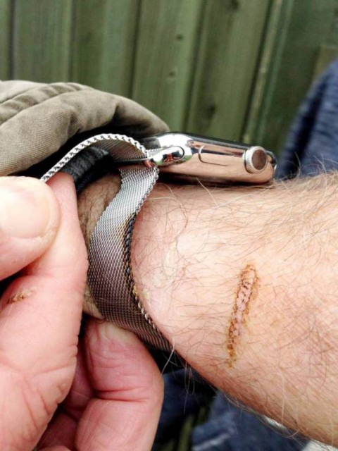 I segni della ustione provocata dal prodotto Apple