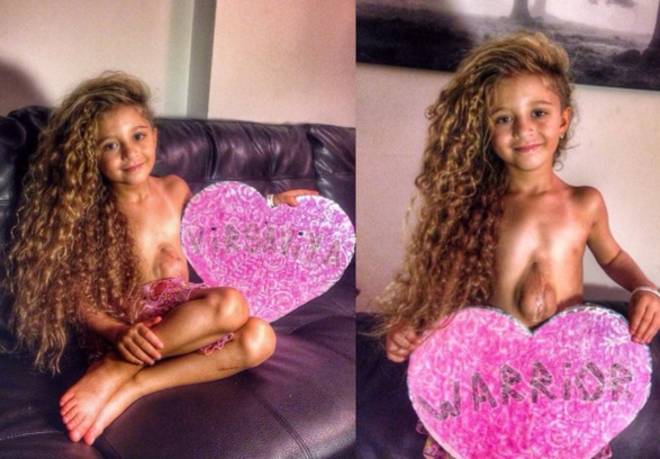 La bambina con il cuore fuori dal petto 3