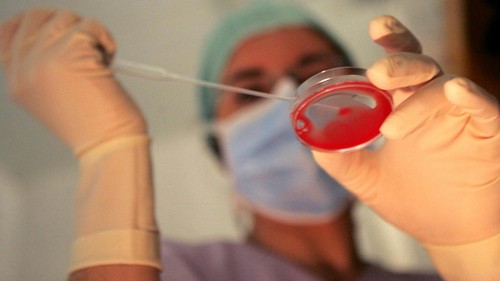 Medico durante fecondazione assistita - 1