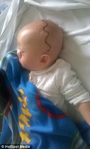 Cicatrice dopo l'operazione