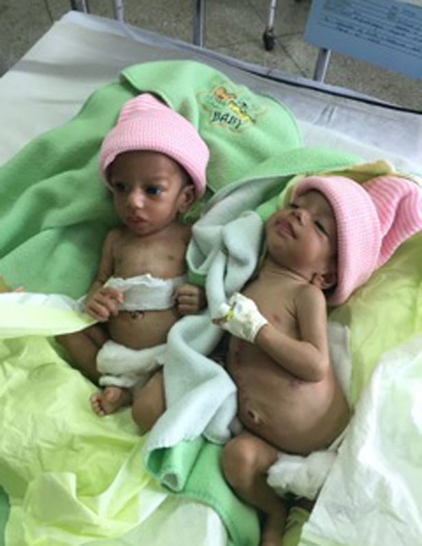 Jannat e Mannat dopo l'intervento 2