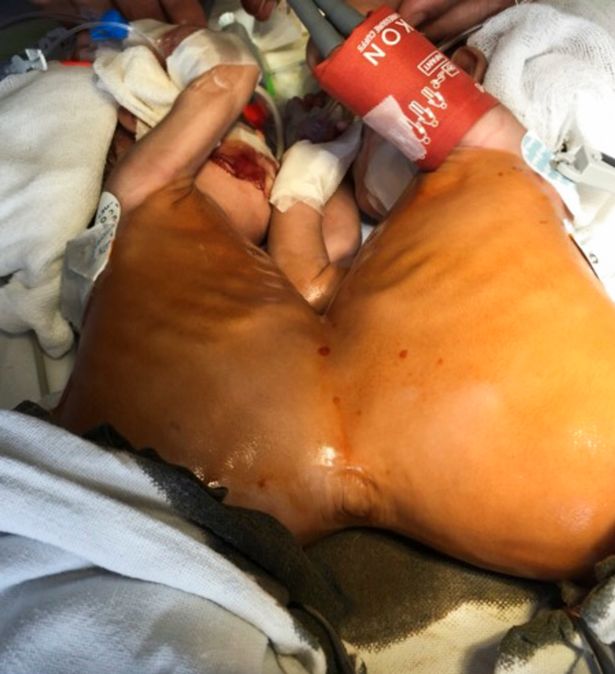 Jannat e Mannat prima dell'intervento 2