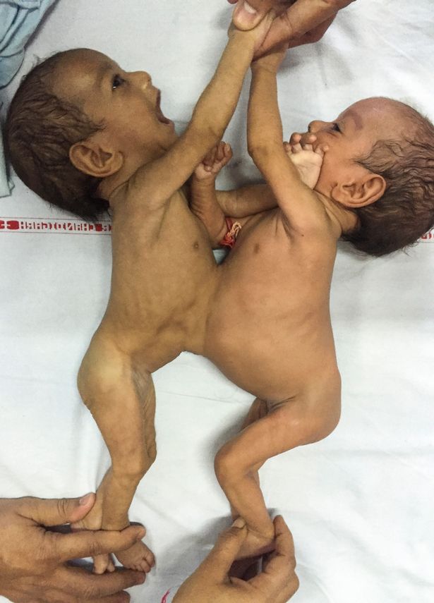 Jannat e Mannat prima dell'intervento