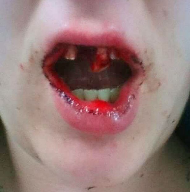 Foto dopo l'aggressione