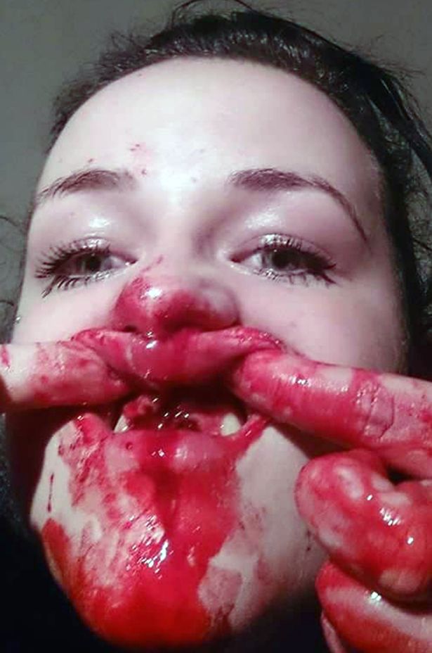 Foto dopo l'aggressione 2