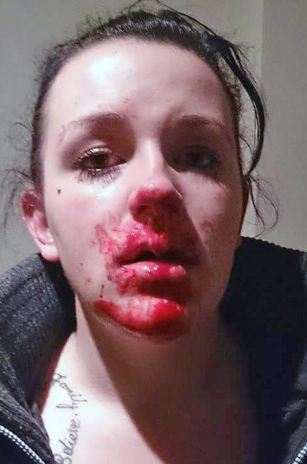 Foto dopo l'aggressione 3