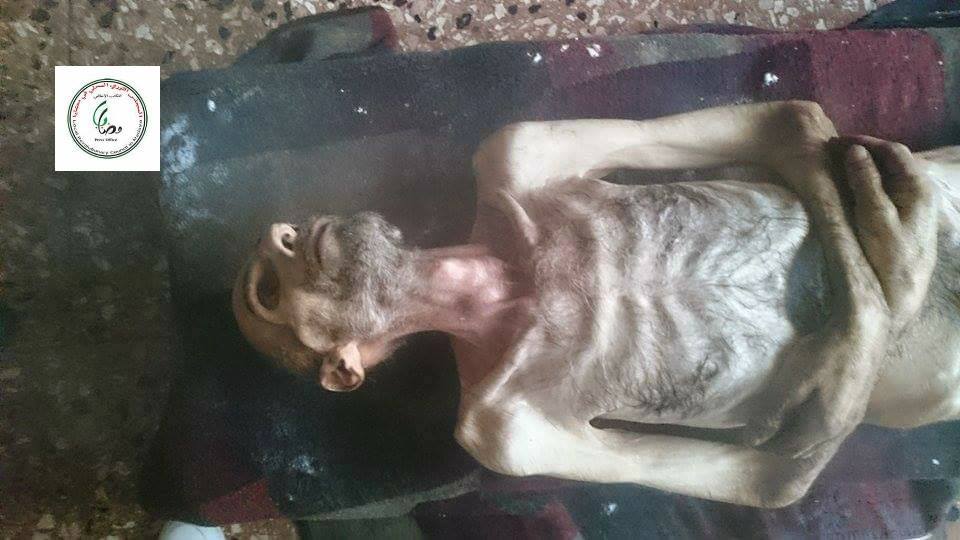 Civile morto di fame a Madaya