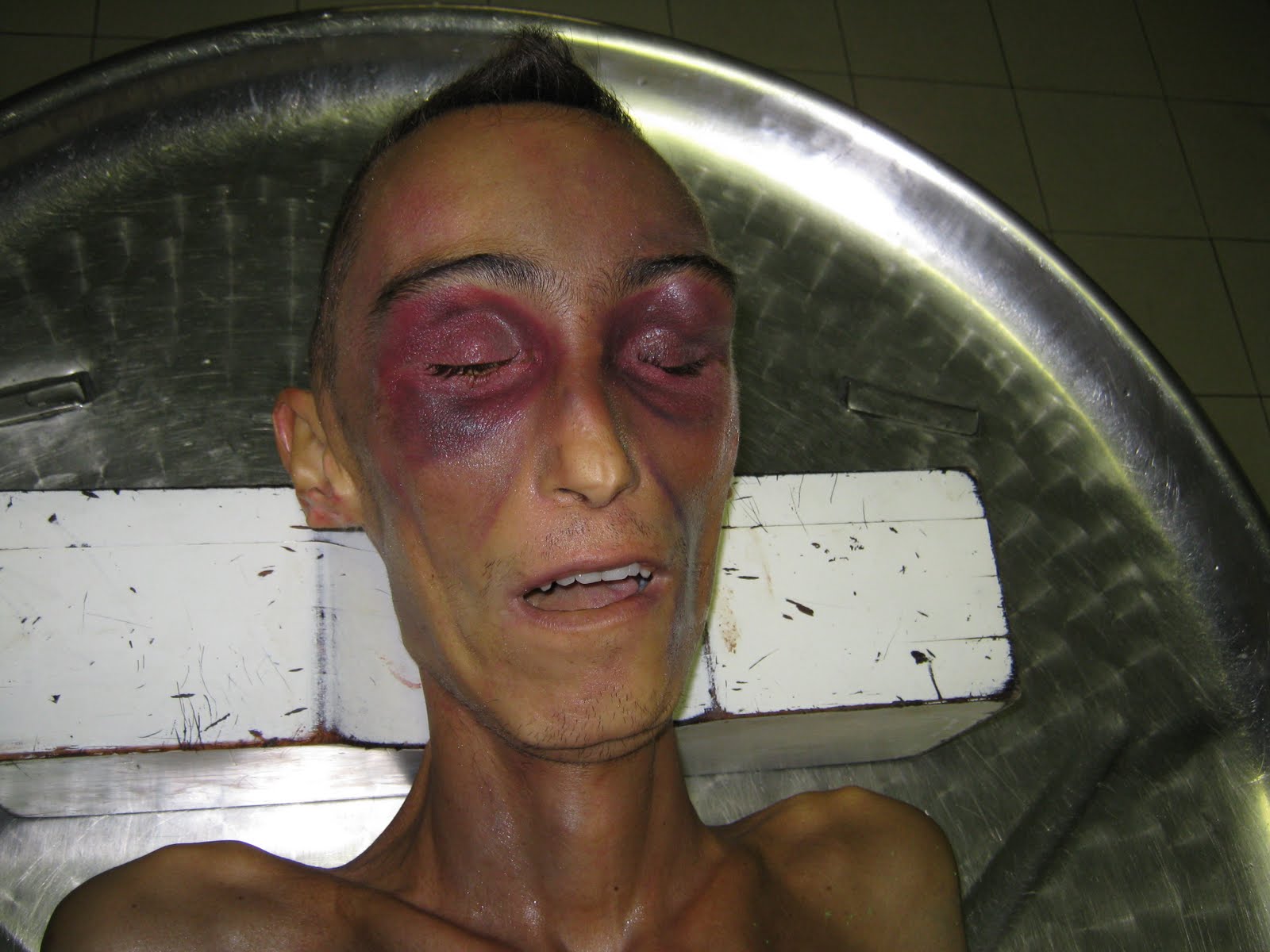 Stefano Cucchi picchiato