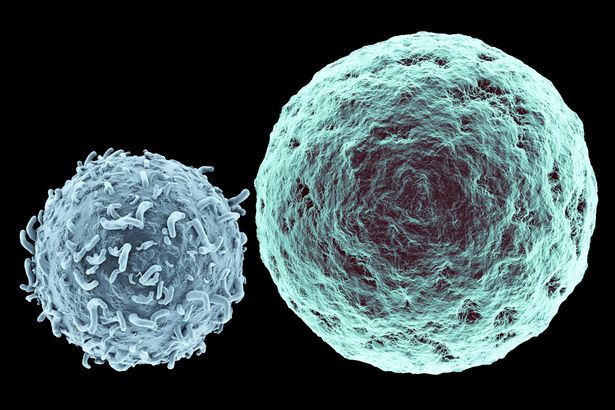 Cellula T che attacca il tumore 2