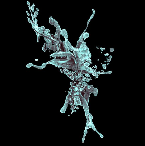 Cellula tumorale distrutta