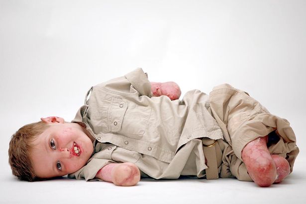 Edward Bright da bambino