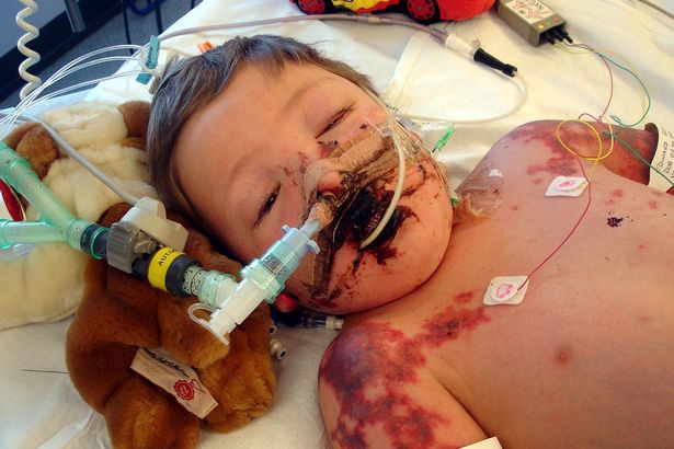 Edward Bright in ospedale