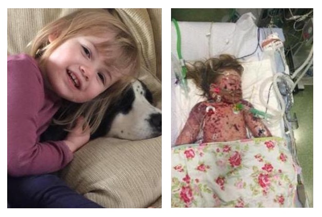 Faye Burdett, 2 anni