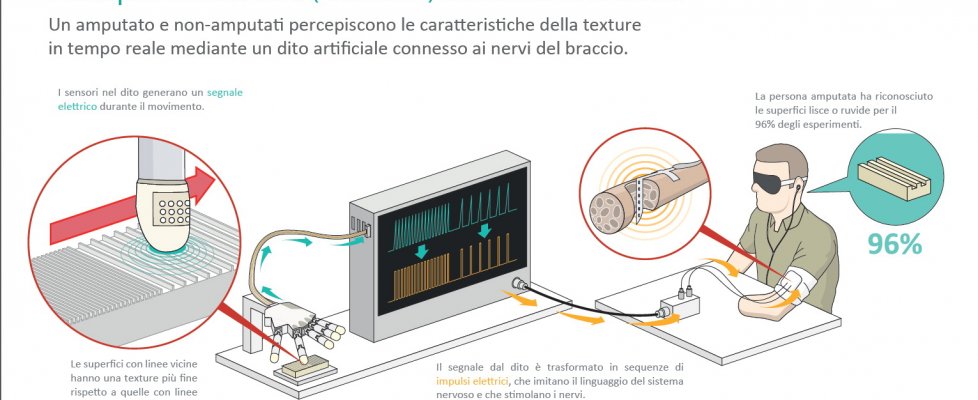 Come funziona il dito bionico