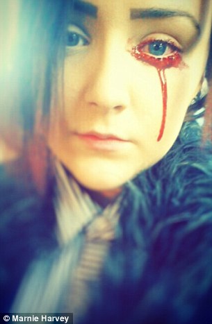 Sangue dall'occhio 4