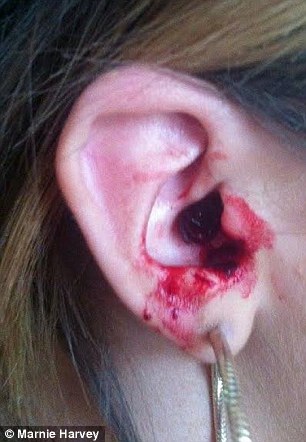 Sangue dall'orecchio