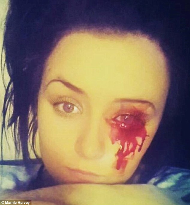 Sangue dall'occhio 3