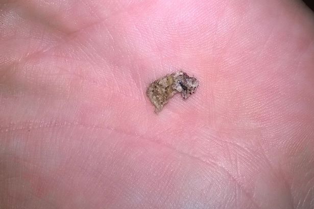 Pezzi dell'oggetto 2