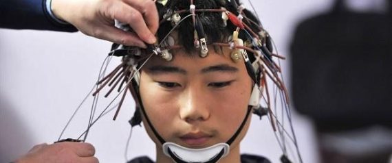 Stimolazione cerebrale