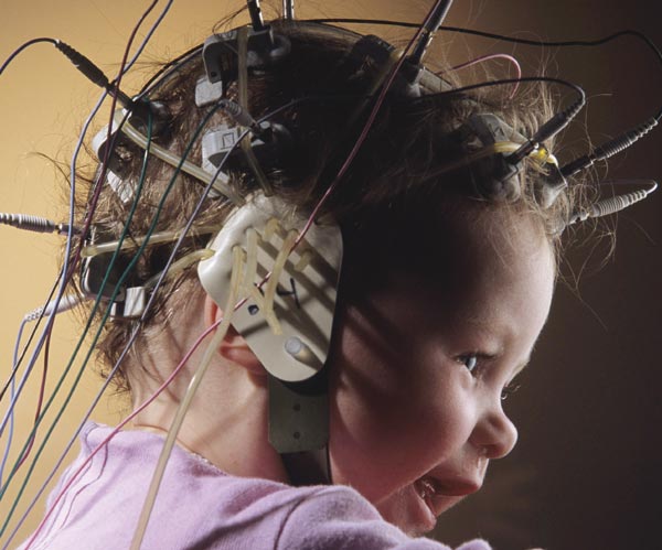 Stimolazione cerebrale 2