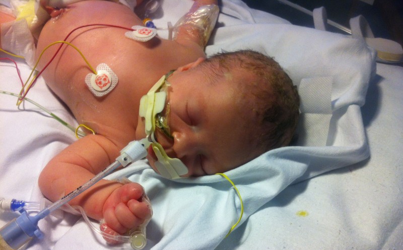 Millie durante il periodo di ricovero in terapia intensiva