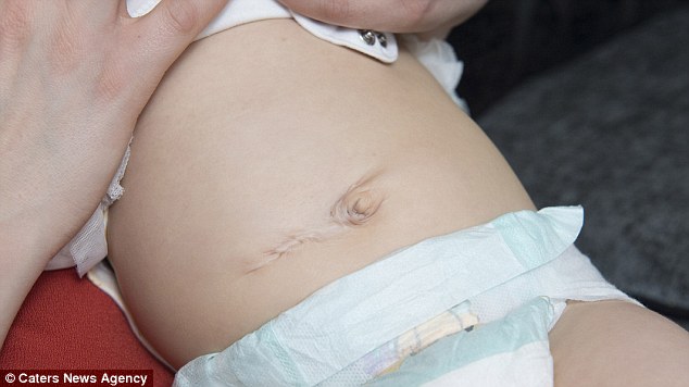 La cicatrice di Millie