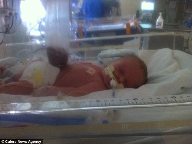 Sacchetto che contiene l'intestino