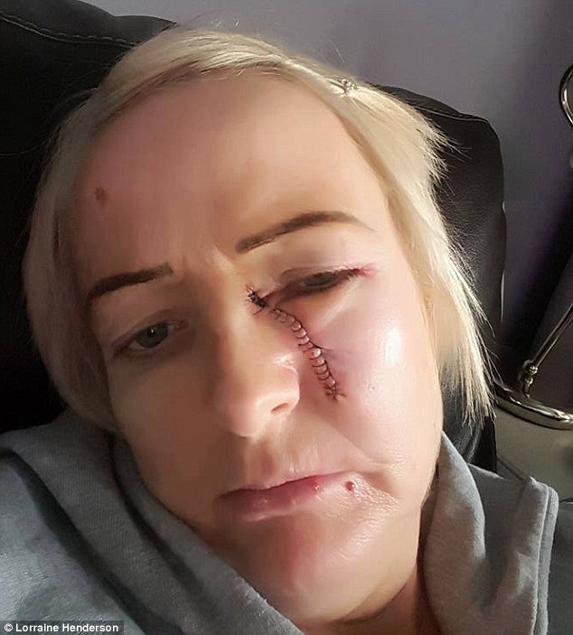 Lorraine dopo intervento